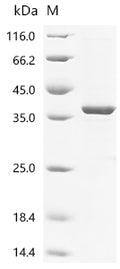 (Tris-Glycine gel) Discontinuous SDS-PAGE (reduced) with 5% enrichment gel and 15% separation gel.