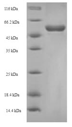 Recombinant Escherichia coli 3-oxoacyl-[acyl-carrier-protein] synthase 2 (fabF) – Figure 1 of 1