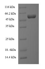 Recombinant Escherichia coli Lipopolysaccharide assembly protein B (lapB), partial – Figure 1 of 1