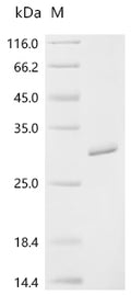 (Tris-Glycine gel) Discontinuous SDS-PAGE (reduced) with 5% enrichment gel and 15% separation gel.