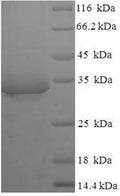 Recombinant Escherichia coli Lipopolysaccharide export system protein lptA (lptA) – Figure 1 of 1