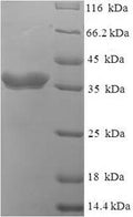 (Tris-Glycine gel) Discontinuous SDS-PAGE (reduced) with 5% enrichment gel and 15% separation gel.