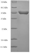 Recombinant Escherichia coli Methionine aminopeptidase (map) – Figure 1 of 1