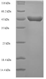 Recombinant Escherichia coli Methionine aminopeptidase (map) – Figure 1 of 1