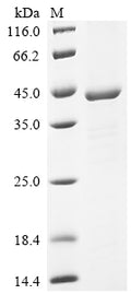 (Tris-Glycine gel) Discontinuous SDS-PAGE (reduced) with 5% enrichment gel and 15% separation gel.