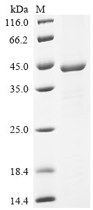 (Tris-Glycine gel) Discontinuous SDS-PAGE (reduced) with 5% enrichment gel and 15% separation gel.