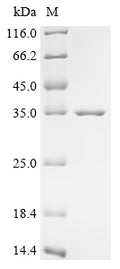 (Tris-Glycine gel) Discontinuous SDS-PAGE (reduced) with 5% enrichment gel and 15% separation gel.