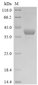 (Tris-Glycine gel) Discontinuous SDS-PAGE (reduced) with 5% enrichment gel and 15% separation gel.