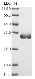 (Tris-Glycine gel) Discontinuous SDS-PAGE (reduced) with 5% enrichment gel and 15% separation gel.