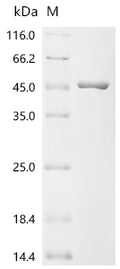 (Tris-Glycine gel) Discontinuous SDS-PAGE (reduced) with 5% enrichment gel and 15% separation gel.