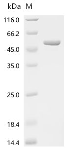 (Tris-Glycine gel) Discontinuous SDS-PAGE (reduced) with 5% enrichment gel and 15% separation gel.