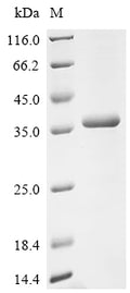 (Tris-Glycine gel) Discontinuous SDS-PAGE (reduced) with 5% enrichment gel and 15% separation gel.