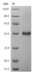 (Tris-Glycine gel) Discontinuous SDS-PAGE (reduced) with 5% enrichment gel and 15% separation gel.