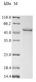 (Tris-Glycine gel) Discontinuous SDS-PAGE (reduced) with 5% enrichment gel and 15% separation gel.