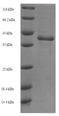 Recombinant Saccharomyces cerevisiae GTP-binding protein YPT1 (YPT1) – Figure 1 of 1