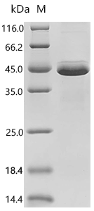 (Tris-Glycine gel) Discontinuous SDS-PAGE (reduced) with 5% enrichment gel and 15% separation gel.