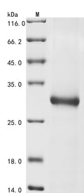 (Tris-Glycine gel) Discontinuous SDS-PAGE (reduced) with 5% enrichment gel and 15% separation gel.