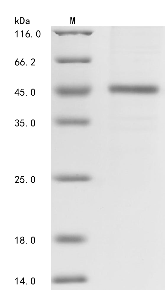 (Tris-Glycine gel) Discontinuous SDS-PAGE (reduced) with 5% enrichment gel and 15% separation gel.
