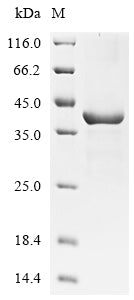 (Tris-Glycine gel) Discontinuous SDS-PAGE (reduced) with 5% enrichment gel and 15% separation gel.