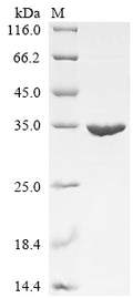 (Tris-Glycine gel) Discontinuous SDS-PAGE (reduced) with 5% enrichment gel and 15% separation gel.