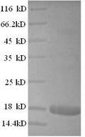 Recombinant Human Interferon alpha-2 (IFNA2) – Figure 1 of 1