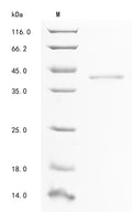 (Tris-Glycine gel) Discontinuous SDS-PAGE (reduced) with 5% enrichment gel and 15% separation gel.