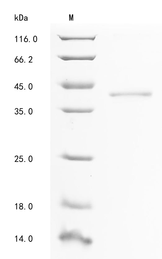 (Tris-Glycine gel) Discontinuous SDS-PAGE (reduced) with 5% enrichment gel and 15% separation gel.