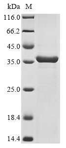 (Tris-Glycine gel) Discontinuous SDS-PAGE (reduced) with 5% enrichment gel and 15% separation gel.