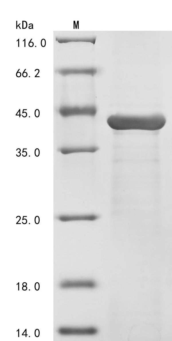 (Tris-Glycine gel) Discontinuous SDS-PAGE (reduced) with 5% enrichment gel and 15% separation gel.
