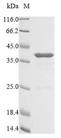 (Tris-Glycine gel) Discontinuous SDS-PAGE (reduced) with 5% enrichment gel and 15% separation gel.