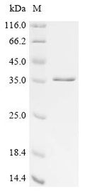 (Tris-Glycine gel) Discontinuous SDS-PAGE (reduced) with 5% enrichment gel and 15% separation gel.