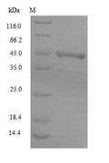 (Tris-Glycine gel) Discontinuous SDS-PAGE (reduced) with 5% enrichment gel and 15% separation gel.