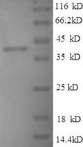 Recombinant BK polyomavirus Minor capsid protein VP2 – Figure 1 of 1