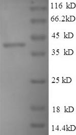 Recombinant BK polyomavirus Minor capsid protein VP2 – Figure 1 of 1