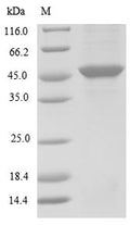 (Tris-Glycine gel) Discontinuous SDS-PAGE (reduced) with 5% enrichment gel and 15% separation gel.