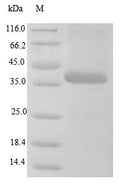 (Tris-Glycine gel) Discontinuous SDS-PAGE (reduced) with 5% enrichment gel and 15% separation gel.