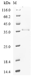 (Tris-Glycine gel) Discontinuous SDS-PAGE (reduced) with 5% enrichment gel and 15% separation gel.