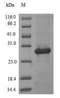 (Tris-Glycine gel) Discontinuous SDS-PAGE (reduced) with 5% enrichment gel and 15% separation gel.