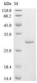 (Tris-Glycine gel) Discontinuous SDS-PAGE (reduced) with 5% enrichment gel and 15% separation gel.