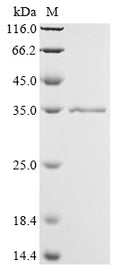 (Tris-Glycine gel) Discontinuous SDS-PAGE (reduced) with 5% enrichment gel and 15% separation gel.