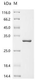 (Tris-Glycine gel) Discontinuous SDS-PAGE (reduced) with 5% enrichment gel and 15% separation gel.