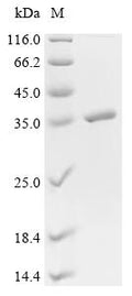 (Tris-Glycine gel) Discontinuous SDS-PAGE (reduced) with 5% enrichment gel and 15% separation gel.