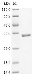 (Tris-Glycine gel) Discontinuous SDS-PAGE (reduced) with 5% enrichment gel and 15% separation gel.