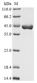 (Tris-Glycine gel) Discontinuous SDS-PAGE (reduced) with 5% enrichment gel and 15% separation gel.
