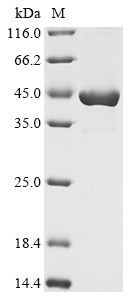 (Tris-Glycine gel) Discontinuous SDS-PAGE (reduced) with 5% enrichment gel and 15% separation gel.