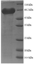 Recombinant Human immunodeficiency virus type 1 group M subtype B Envelope glycoprotein gp160 (env), partial – Figure 1 of 1