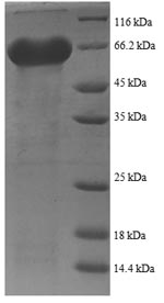 Recombinant Human immunodeficiency virus type 1 group M subtype B Envelope glycoprotein gp160 (env), partial – Figure 1 of 1
