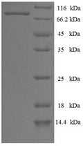 Recombinant Influenza B virus Nucleoprotein (NP) – Figure 1 of 1
