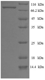 Recombinant Influenza B virus Nucleoprotein (NP) – Figure 1 of 1