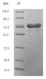 (Tris-Glycine gel) Discontinuous SDS-PAGE (reduced) with 5% enrichment gel and 15% separation gel.